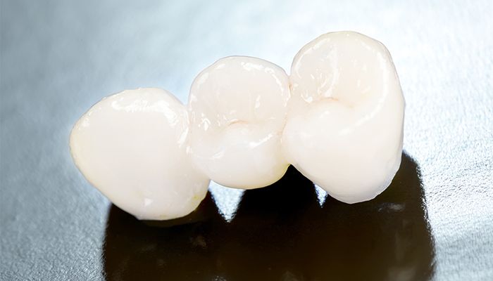 幅広い症状に対応／「保険で白い歯」も可能