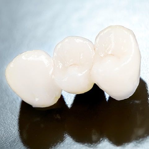 幅広い症状に対応「保険で白い歯」も可能