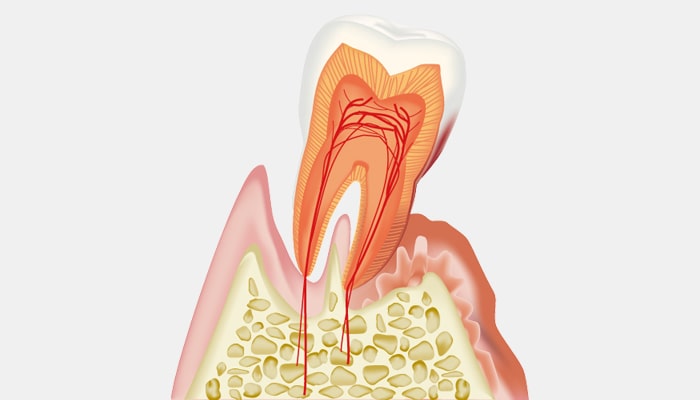 歯性感染症